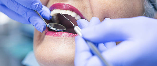 Best Emergency Broken Tooth Repair in Copperton, UT